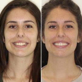 casos clínicos ortodontia