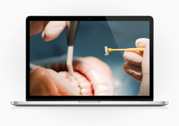Facetas Dentárias – de A a Z.