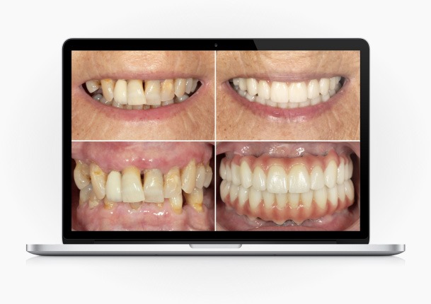 Posso ter um sorriso novo em 1 dia?