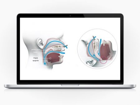 Apneia do sono – Como se suspeita e diagnostica?