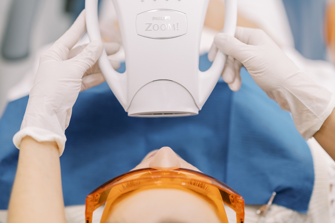 branqueamento dentário