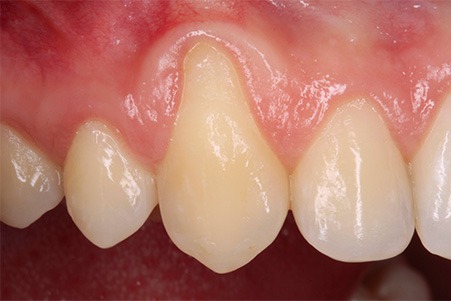 periodontologia