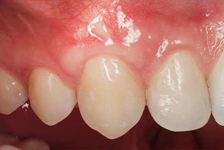 periodontologia