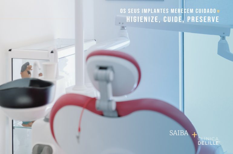 Implantes Dentários – Hábitos que garantem saúde e longevidade