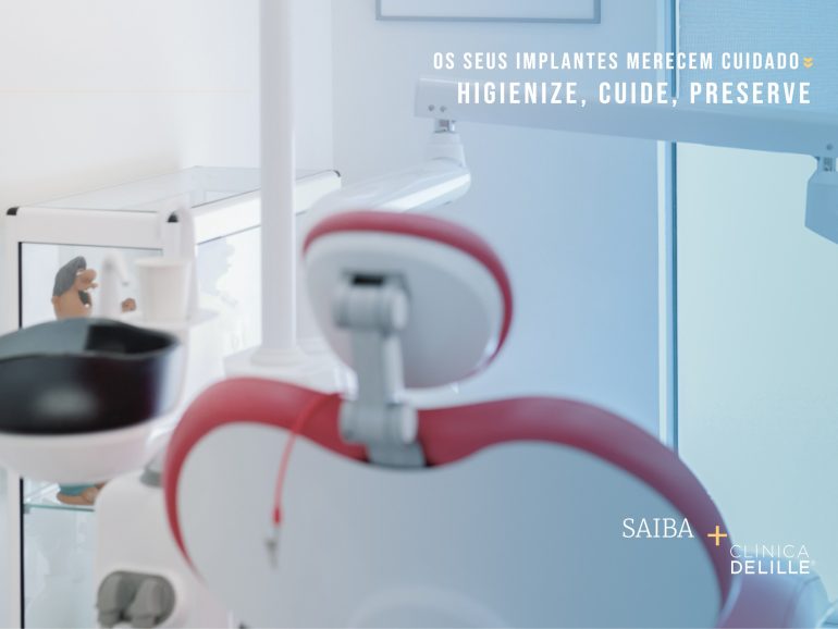Implantes Dentários – Hábitos que garantem saúde e longevidade