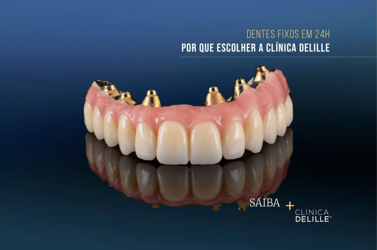 Dentes Fixos em 24h – Por que escolher a Clínica Delille