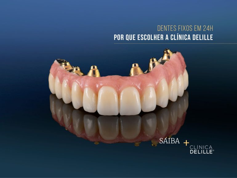 Dentes Fixos em 24h – Por que escolher a Clínica Delille