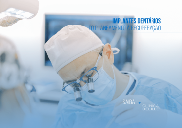 Implantes dentários: Do planeamento à recuperação