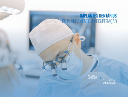 Implantes dentários: Do planeamento à recuperação